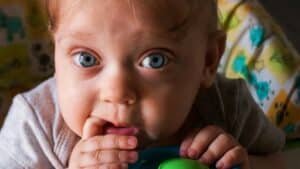 Occhi rossi e palpebre gonfie di tuo figlio?